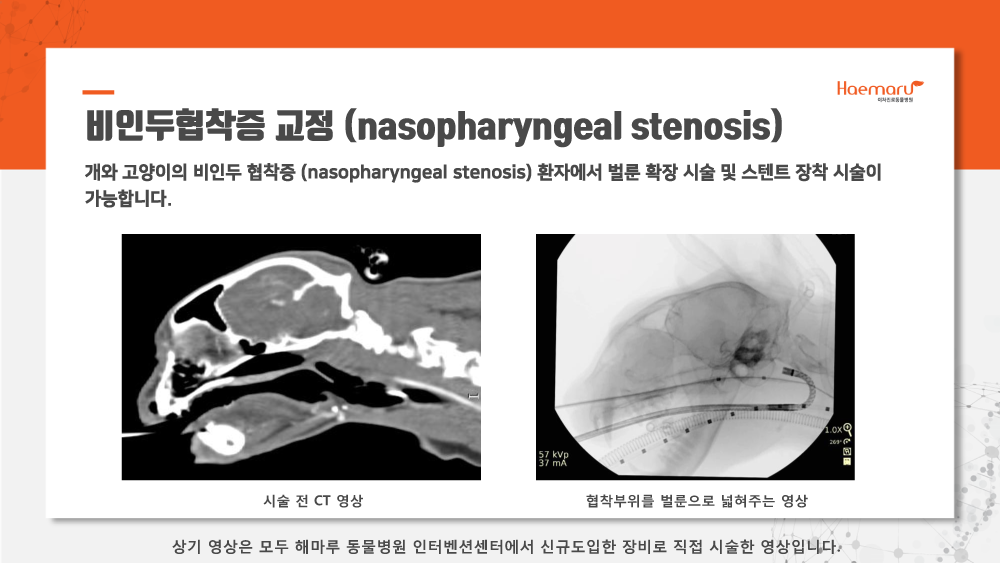 인터벤션센터_업데이트8.png