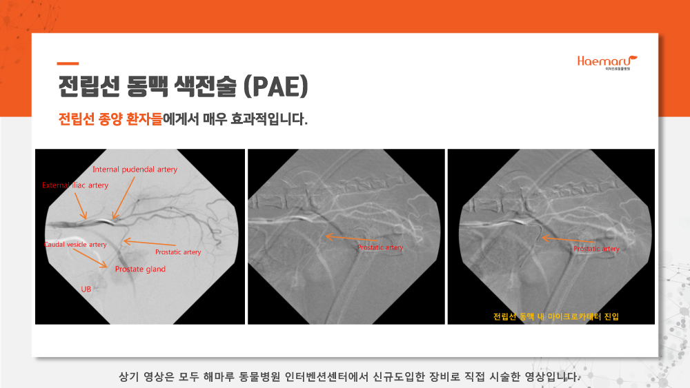 인터벤션센터_업데이트4.png