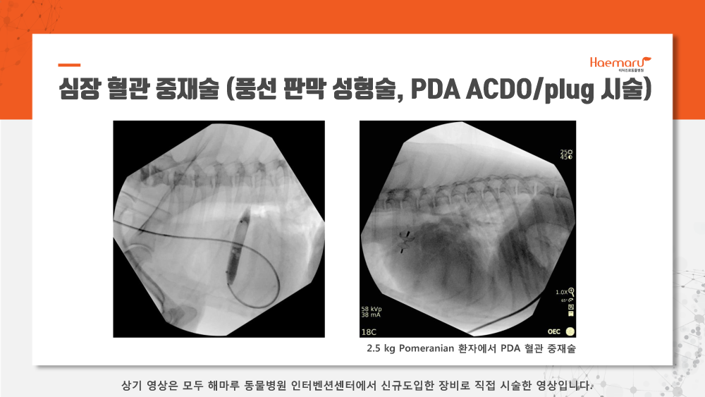 인터벤션센터_업데이트3.png